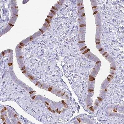 Immunohistochemistry-Paraffin: CAPSL Antibody [NBP2-32387]