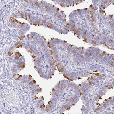 Immunohistochemistry-Paraffin: CAPSL Antibody [NBP2-32387]