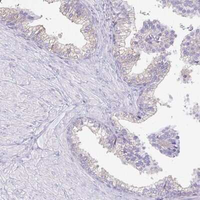 Immunohistochemistry-Paraffin: CAPSL Antibody [NBP2-32387]