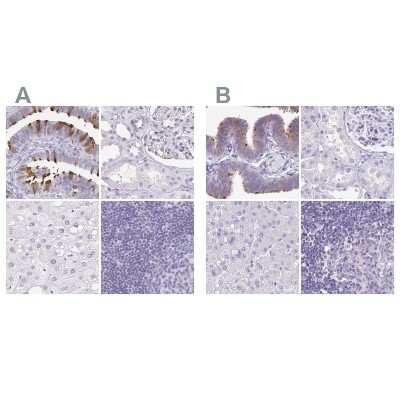 Immunohistochemistry-Paraffin: CAPSL Antibody [NBP2-32387]