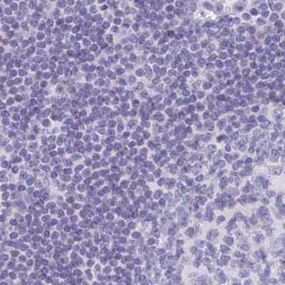 Immunohistochemistry-Paraffin: CAPSL Antibody [NBP2-32387]