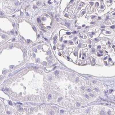 Immunohistochemistry-Paraffin: CAPSL Antibody [NBP2-32387]