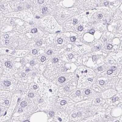 Immunohistochemistry-Paraffin: CAPSL Antibody [NBP2-32387]