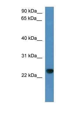 Western Blot: CAPSL Antibody [NBP1-79507]