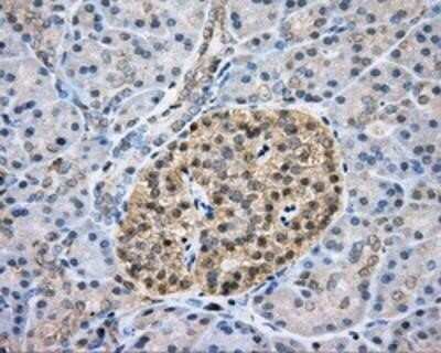 Immunohistochemistry: CAPZA1 Antibody (OTI2G4) - Azide and BSA Free [NBP2-70336]
