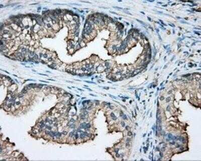 Immunohistochemistry: CAPZA1 Antibody (OTI2G4) - Azide and BSA Free [NBP2-70336]