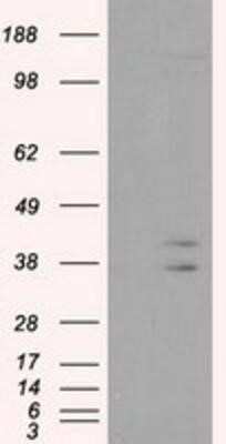 Western Blot: CAPZA1 Antibody (OTI2G4)Azide and BSA Free [NBP2-70336]