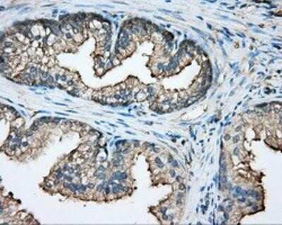 Immunohistochemistry-Paraffin: CAPZA1 Antibody (OTI2G4) [NBP2-02500]