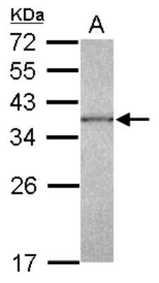 Western Blot: CAPZA1 Antibody [NBP2-15692]