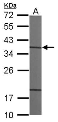 Western Blot: CAPZA1 Antibody [NBP2-15692]