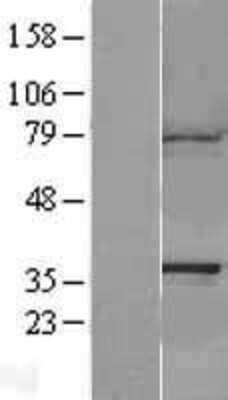 Western Blot: CAPZA1 Overexpression Lysate [NBL1-08690]