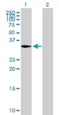 Western Blot: CAPZA2 Antibody [H00000830-B01P]