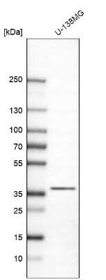 Western Blot: CAPZA2 Antibody [NBP1-86632]