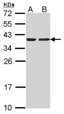 Western Blot: CAPZA2 Antibody [NBP2-15694]