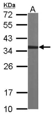 Western Blot: CAPZA2 Antibody [NBP2-15694]