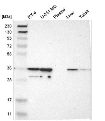 Western Blot: CAPZA2 Antibody [NBP2-58907]