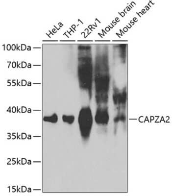 Western Blot: CAPZA2 AntibodyAzide and BSA Free [NBP2-92643]