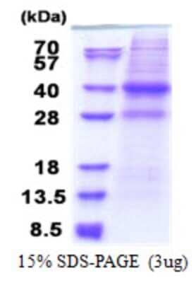 SDS-PAGE: Recombinant Human CAPZA2 His Protein [NBP2-22730]