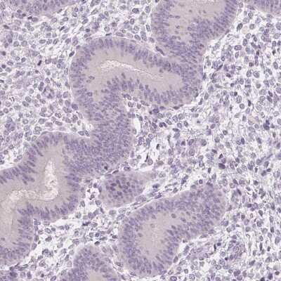 Immunohistochemistry-Paraffin: CAPZA3 Antibody [NBP2-38425]