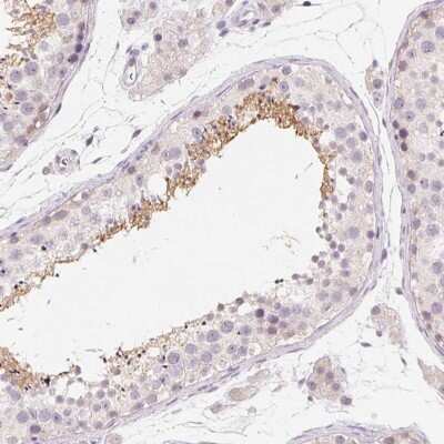 Immunohistochemistry-Paraffin: CAPZA3 Antibody [NBP2-38425]