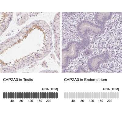 Immunohistochemistry-Paraffin: CAPZA3 Antibody [NBP2-38425]
