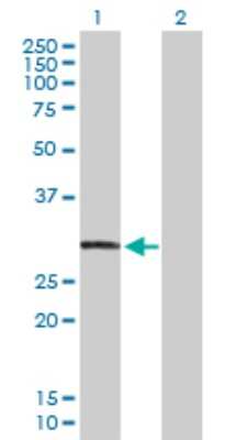 Western Blot: CAPZA3 Antibody [H00093661-D01P]