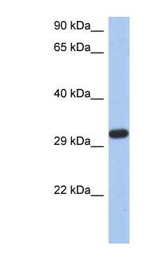 Western Blot: CAPZA3 Antibody [NBP1-56416]