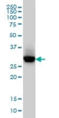 Western Blot: CAPZB Antibody (4H8) [H00000832-M03]