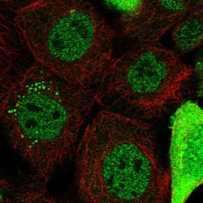Immunocytochemistry/ Immunofluorescence: CAPZB Antibody [NBP1-85922]