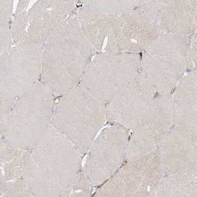 Immunohistochemistry-Paraffin: CAPZB Antibody [NBP1-85922]