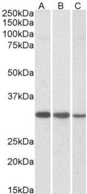 Western Blot: CAPZB Antibody [NB100-814]