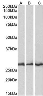 Western Blot: CAPZB Antibody [NB100-814]