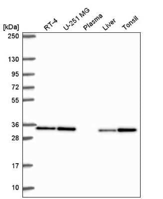 Western Blot: CAPZB Antibody [NBP2-54936]