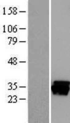 Western Blot: CAPZB Overexpression Lysate [NBL1-08693]