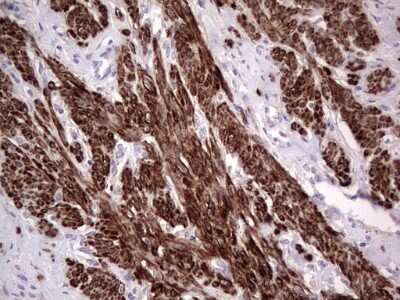 Immunohistochemistry: CAR/NR1I3 Antibody (OTI1C6) [NBP2-46226]
