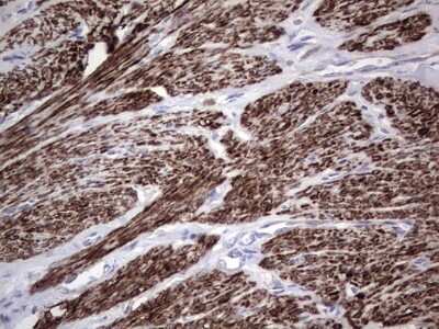 Immunohistochemistry: CAR/NR1I3 Antibody (OTI1C6) [NBP2-46226]