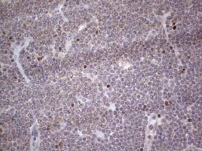Immunohistochemistry: CAR/NR1I3 Antibody (OTI1C6) [NBP2-46226]