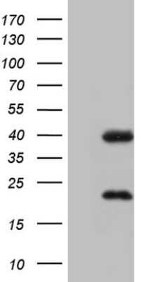 Western Blot: CAR/NR1I3 Antibody (OTI1C6) [NBP2-46226]