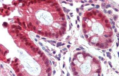 Immunohistochemistry-Paraffin: CAR/NR1I3 Antibody [NBP1-54935]