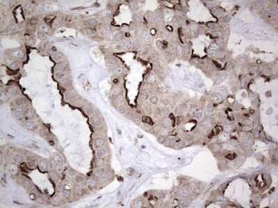 Immunohistochemistry: CAR/NR1I3 Antibody (OTI1C6) - Azide and BSA Free [NBP2-71525]