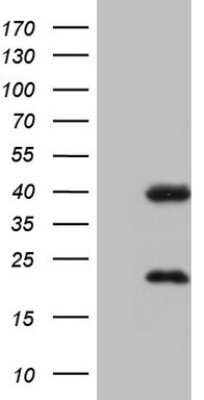 Western Blot: CAR/NR1I3 Antibody (OTI1C6)Azide and BSA Free [NBP2-71525]