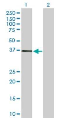 Western Blot: CAR/NR1I3 Antibody [H00009970-D01P]