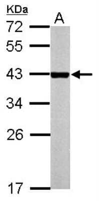 Western Blot: CAR/NR1I3 Antibody [NBP2-19577]