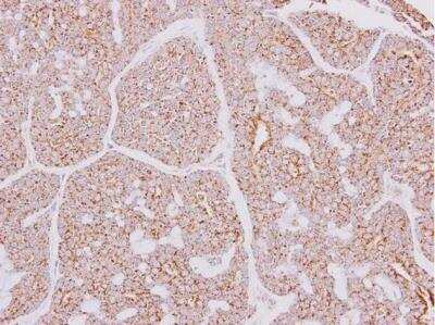 Immunohistochemistry-Paraffin: CARD10 Antibody [NBP1-33042]