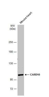 Western Blot: CARD10 Antibody [NBP1-33042]