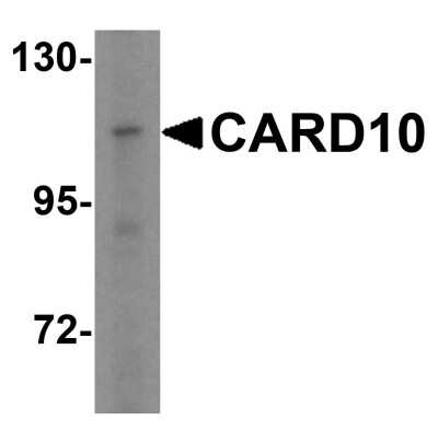 Western Blot: CARD10 AntibodyBSA Free [NBP1-76676]