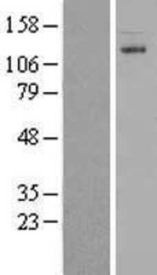 Western Blot: CARD10 Overexpression Lysate [NBL1-08694]