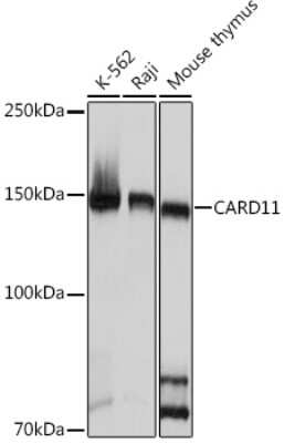 Western Blot: CARD11/CARMA1 Antibody (8N4C9) [NBP3-16849]