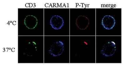 Immunocytochemistry/ Immunofluorescence: CARD11/CARMA1 Antibody [NBP2-80110]