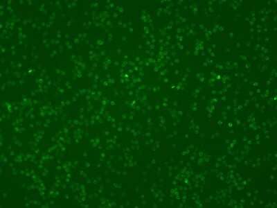 Immunocytochemistry/ Immunofluorescence: CARD11/CARMA1 Antibody [NBP2-99265]